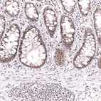 Immunohistochemical staining of human rectum shows moderate nuclear positivity in glandular cells.