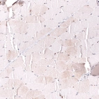 Immunohistochemical staining of human skeletal muscle shows no nuclear positivity in myocytes as expected.