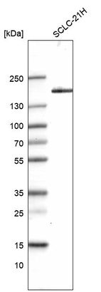 Western blot analysis in human cell line SCLC-21H.