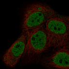 Immunofluorescence staining in A-431 cell line with Anti-MLH3 monoclonal antibody, showing specific staining of nucleoplasm in green. Microtubule- and nuclear probes are visualized in red and blue respectively (where available).
