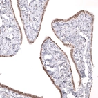 Immunohistochemical staining of human fallopian tube shows moderate nuclear positivity in glandular cells.