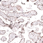 Immunohistochemical staining of human placenta shows moderate nuclear positivity in trophoblastic cells.