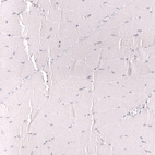 Immunohistochemical staining of human skeletal muscle shows no positivity in myocytes as expected.