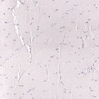 Immunohistochemical staining of human skeletal muscle shows no positivity in myocytes as expected.