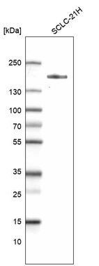 Western blot analysis in human cell line SCLC-21H.