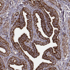 Anti-TUFM Antibody
