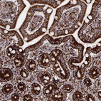 Immunohistochemical staining of human duodenum shows strong granular cytoplasmic positivity in glandular cells.