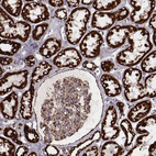 Immunohistochemical staining of human kidney shows strong granular cytoplasmic positivity in cells in tubules and moderate positivity in glomeruli.