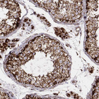 Immunohistochemical staining of human testis shows strong granular cytoplasmic positivity in cells in seminiferous ducts, as well as in Leydig cells.