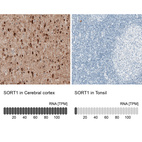 Anti-SORT1 Antibody