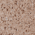 Immunohistochemical staining of human cerebral cortex shows strong cytoplasmic positivity in neurons.