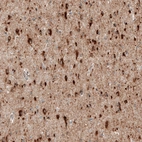 Immunohistochemical staining of human cerebral cortex shows strong cytoplasmic positivity in neurons.