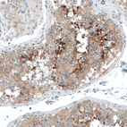 Immunohistochemical staining of human testis shows moderate to strong cytoplasmic positivity in cells in seminiferous ducts.