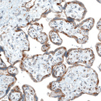 Immunohistochemical staining of human placenta shows moderate cytoplasmic positivity in trophoblastic cells.