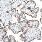 Immunohistochemical staining of human placenta shows moderate cytoplasmic positivity in trophoblastic cells.