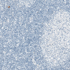 Immunohistochemical staining of human tonsil shows no positivity in lymphoid cells as expected.