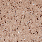 Immunohistochemical staining of mouse cerebral cortex shows strong cytoplasmic positivity in neurons.