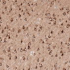 Immunohistochemical staining of mouse cerebral cortex shows strong cytoplasmic positivity in neurons.