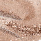 Immunohistochemical staining of mouse hippocampus shows strong cytoplasmic positivity in both pyramidal neurons and granular cells.
