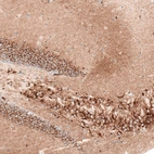 Immunohistochemical staining of mouse hippocampus shows strong cytoplasmic positivity in both pyramidal neurons and granular cells.