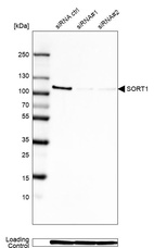Western blot analysis in Rh30 cells transfected with control siRNA, target specific siRNA probe #1 and #2, using Anti-SORT1 antibody. Remaining relative intensity is presented. Loading control: Anti-GAPDH.