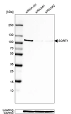 Western blot analysis in Rh30 cells transfected with control siRNA, target specific siRNA probe #1 and #2, using Anti-SORT1 antibody. Remaining relative intensity is presented. Loading control: Anti-GAPDH.