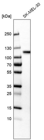 Western blot analysis in human cell line SK-MEL-30.