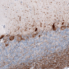 Immunohistochemical staining of human cerebellum shows moderate cytoplasmic positivity in Purkinje cells.