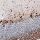 Immunohistochemical staining of human cerebellum shows moderate cytoplasmic positivity in Purkinje cells.