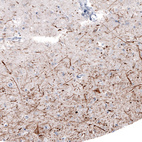 Immunohistochemical staining of human cerebral cortex shows strong positivity in neuronal processes as well as in some neuronal cell bodies.