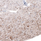 Immunohistochemical staining of human cerebral cortex shows strong positivity in neuronal processes as well as in some neuronal cell bodies.