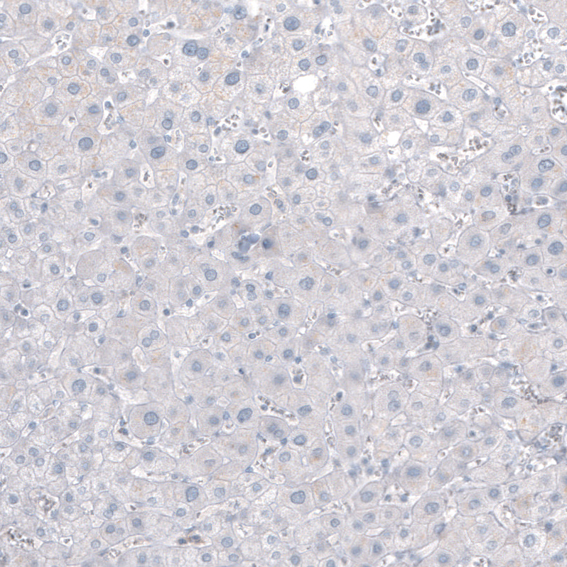 Mouse Monoclonal AntiNEFH Antibody Buy for research Highly