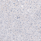 Immunohistochemical staining of human liver shows no positivity in hepatocytes as expected.