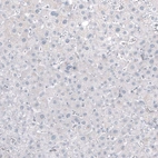 Immunohistochemical staining of human liver shows no positivity in hepatocytes as expected.