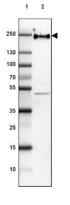 Lane 1: Marker [kDa] 250, 130, 100, 70, 55, 35, 25, 15, 10_br/_Lane 2: Human Cerebral Cortex tissue