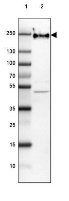 Lane 1: Marker [kDa] 250, 130, 100, 70, 55, 35, 25, 15, 10_br/_Lane 2: Human Cerebral Cortex tissue