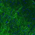 Anti-NEFM Antibody