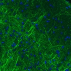 Immunohistochemical staining of mouse cerebral cortex shows strong immunoreactivity in neuronal processes.