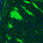 Immunohistochemical staining of rat striatum shows strong positivity in neural fibers.