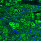 Immunohistochemical staining of mouse trigeminal ganglion shows strong positivity in primary sensory neurons.