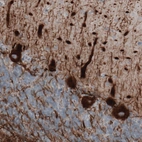 Immunohistochemical staining of human cerebellum shows strong immunoreactivity in Purkinje cells and neuronal processes.