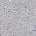 Immunohistochemical staining of human liver shows absence of immunoreactivity (negative control).