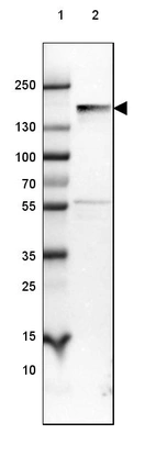 Lane 1: Marker [kDa] 250, 130, 100, 70, 55, 35, 25, 15, 10_br/_Lane 2: Human Cerebral Cortex tissue
