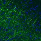Immunohistochemical staining of mouse cerebral cortex shows strong immunoreactivity in neurofilaments.