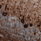 Immunohistochemical staining of human cerebellum shows strong immunoreactivity in Purkinje cells and neuronal processes.