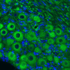 Immunohistochemical staining of mouse trigeminal ganglion shows strong positivity in primary sensory neurons.