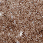 Anti-NEFM Antibody