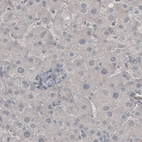 Immunohistochemical staining of human liver shows absence of immunoreactivity (negative control).