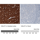 Anti-SLC17A7 Antibody