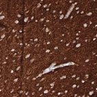Immunohistochemical staining of human cerebral cortex shows strong positivity in neuropil.